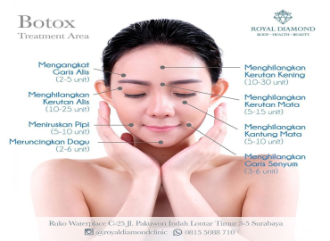 Injeksi Botulinum Toxin