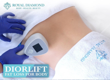 Subcutaneous Fat (Belly Fat)